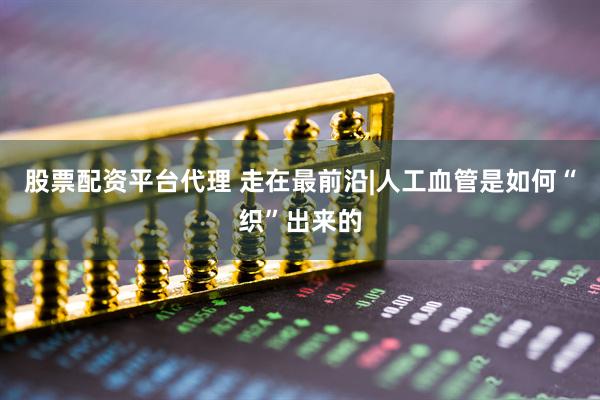 股票配资平台代理 走在最前沿|人工血管是如何“织”出来的